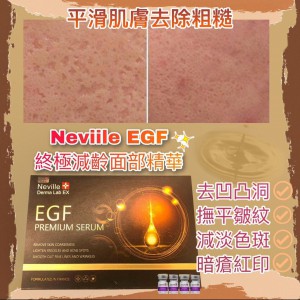 Neville Derma Lab EX Premium Serum【EGF終極減齡面部精華】