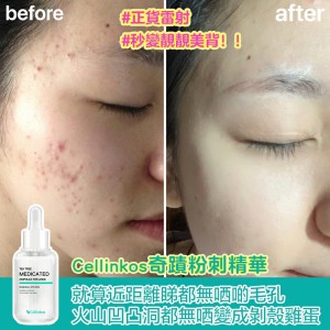Cellinkos 奇蹟粉刺精華 30ml